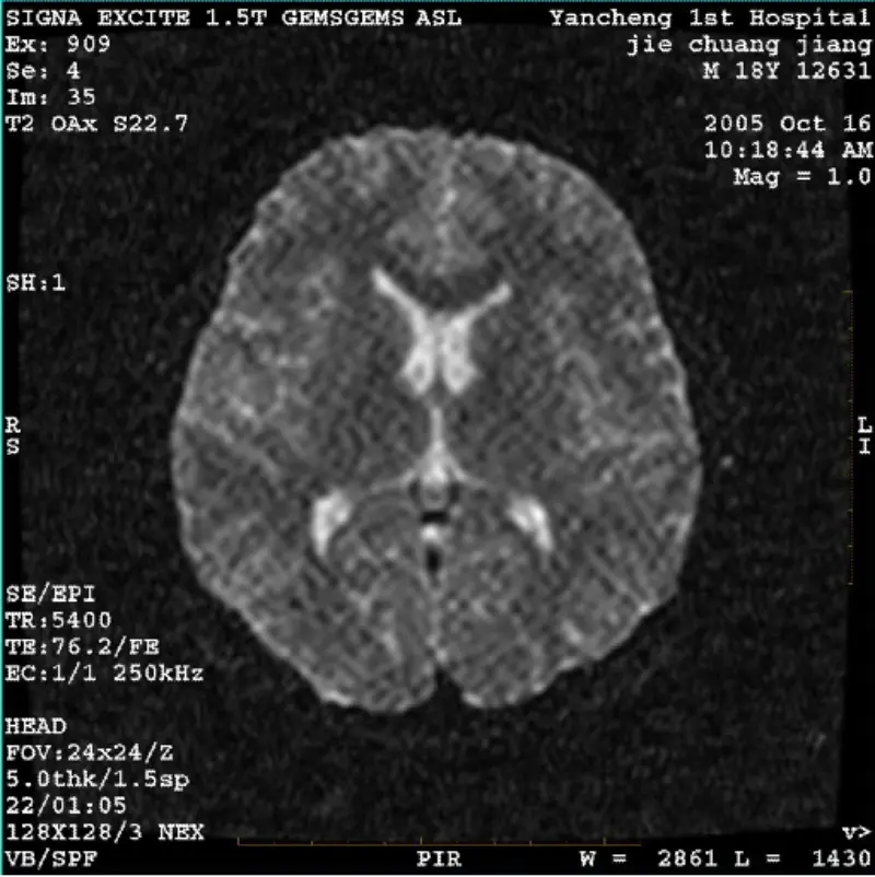 ARTEFACT WI/Fiesta Irudia Pixel zuria